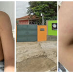 Mãe denuncia maus-tratos contra filho autista em escola