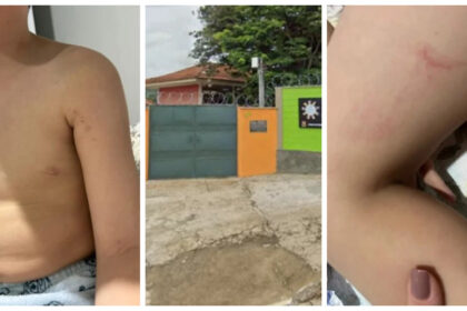 Mãe denuncia maus-tratos contra filho autista em escola