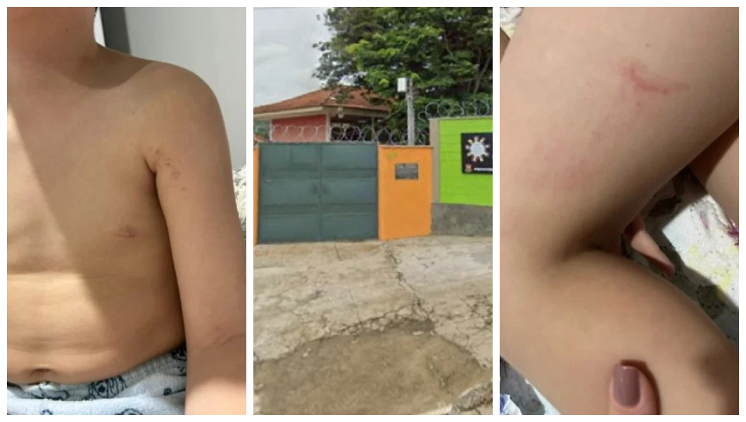 Mãe denuncia maus-tratos contra filho autista em escola