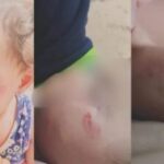 Bebê de 1 ano sofre lesões por mordidas na escola particular Educart Baby e Kids, em Divinópolis